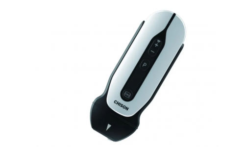 УЗИ система Chison SonoTouch 30 (SonoEye)